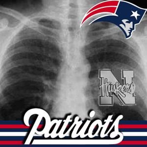 Meet your Posher, Kip